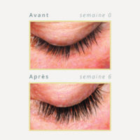 Amplifeye Advanced